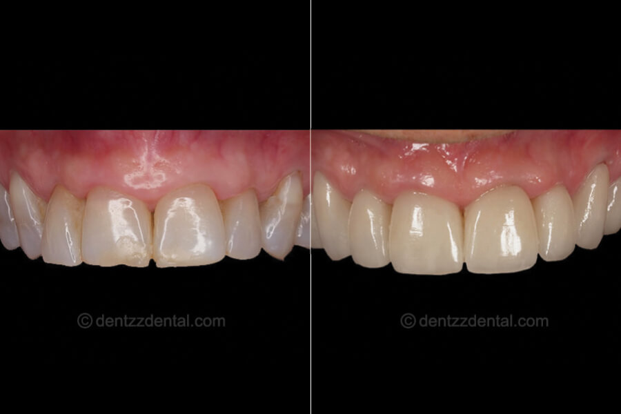 Dentzz Dental